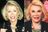 joan-rivers-plastic-surgery-before-and-after.jpg