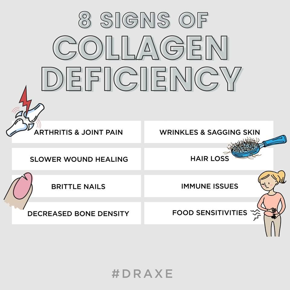 signs of collagen deficiency.jpg