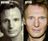 liam-neeson-plastic-surgery.jpg