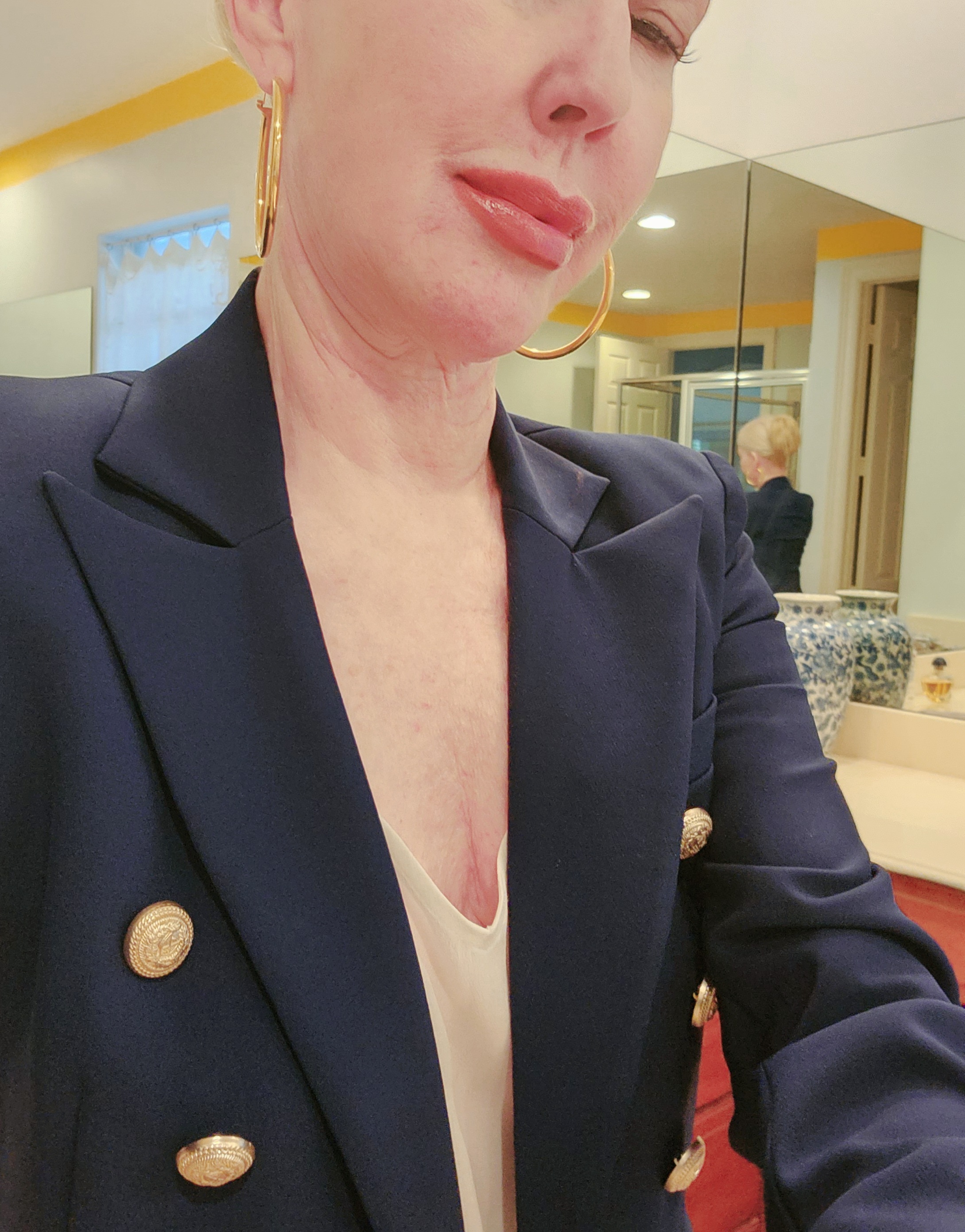 I Had RHA Lip Injections Today 💋 - Blogs & Forums