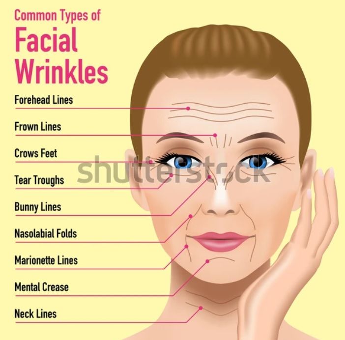 pic--Common-Types-of-Facial-Lines.jpg