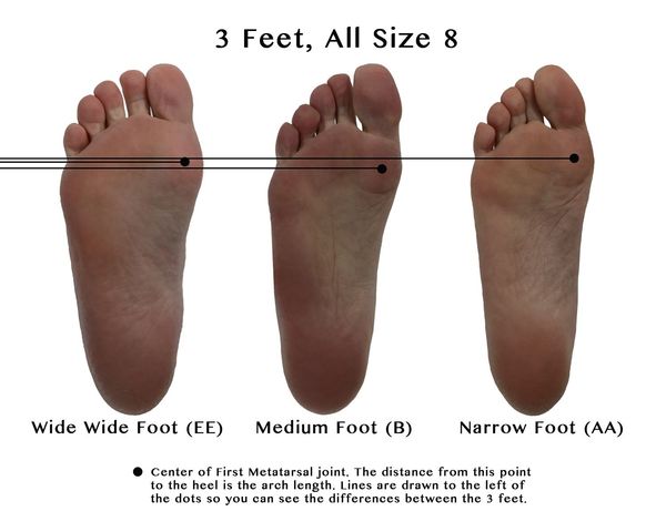Foot-Comparison-small-1.jpg